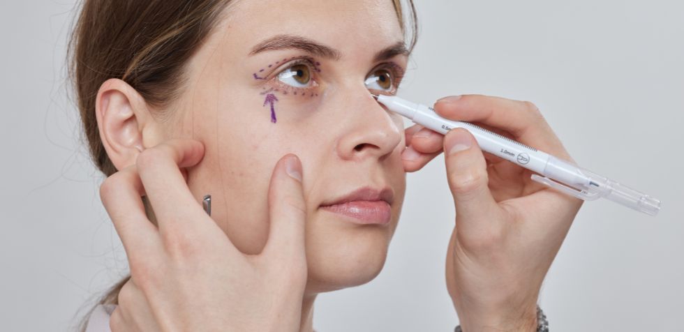 Conoce todo sobre el proceso de la blefaroplastia.