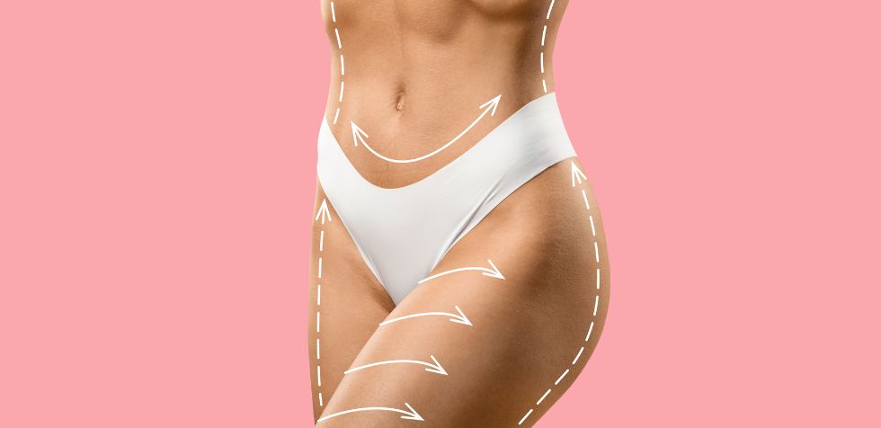 La lipoescultura VASER es una técnica avanzada que utiliza ultrasonido de alta frecuencia para disolver la grasa de manera selectiva.