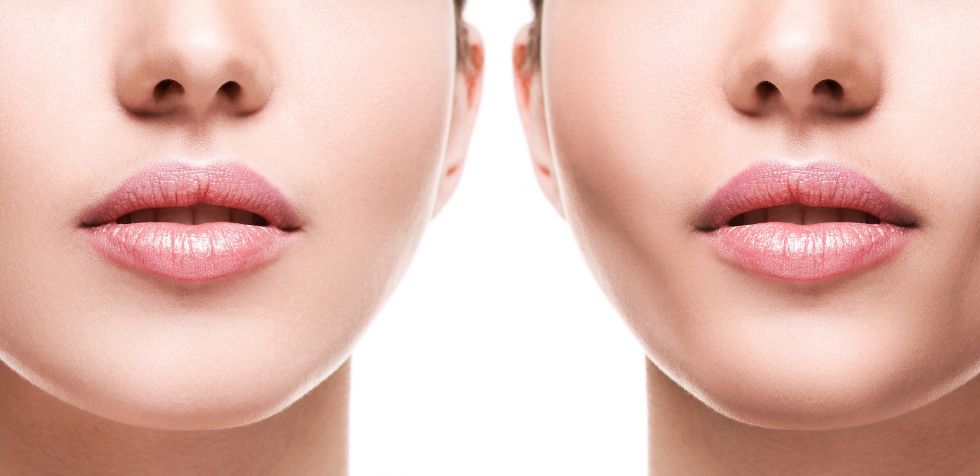 Conoce aquí en qué consiste la bichectomía, cuál es su procedimiento y qué beneficios brinda a los pacientes.