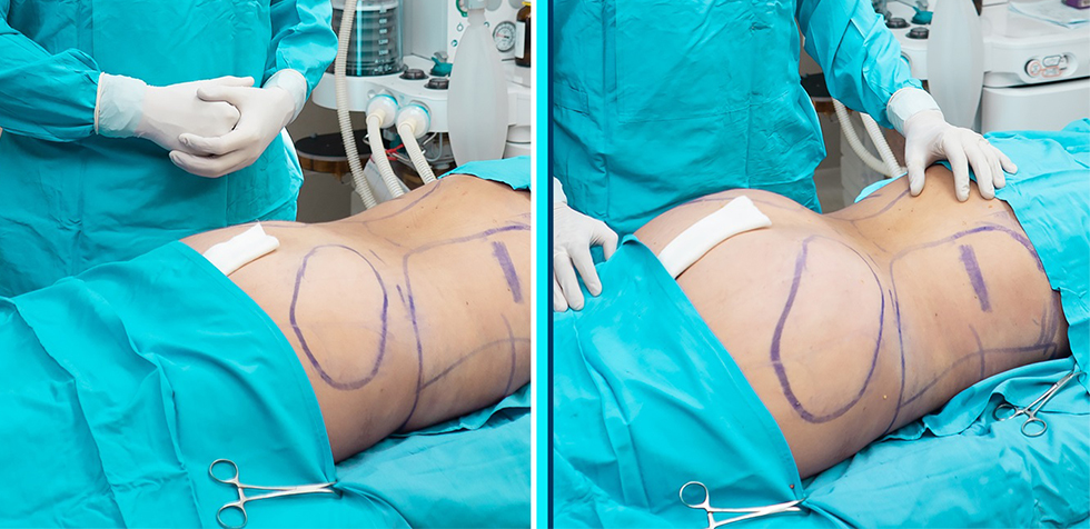 dr ivan guanilo: uno de los mejores cirujanos plásticos del Perú