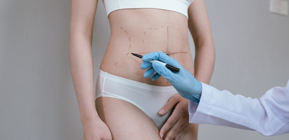Si has pasado por cambios drásticos de peso o embarazos, es probable que estés considerando una abdominoplastia.